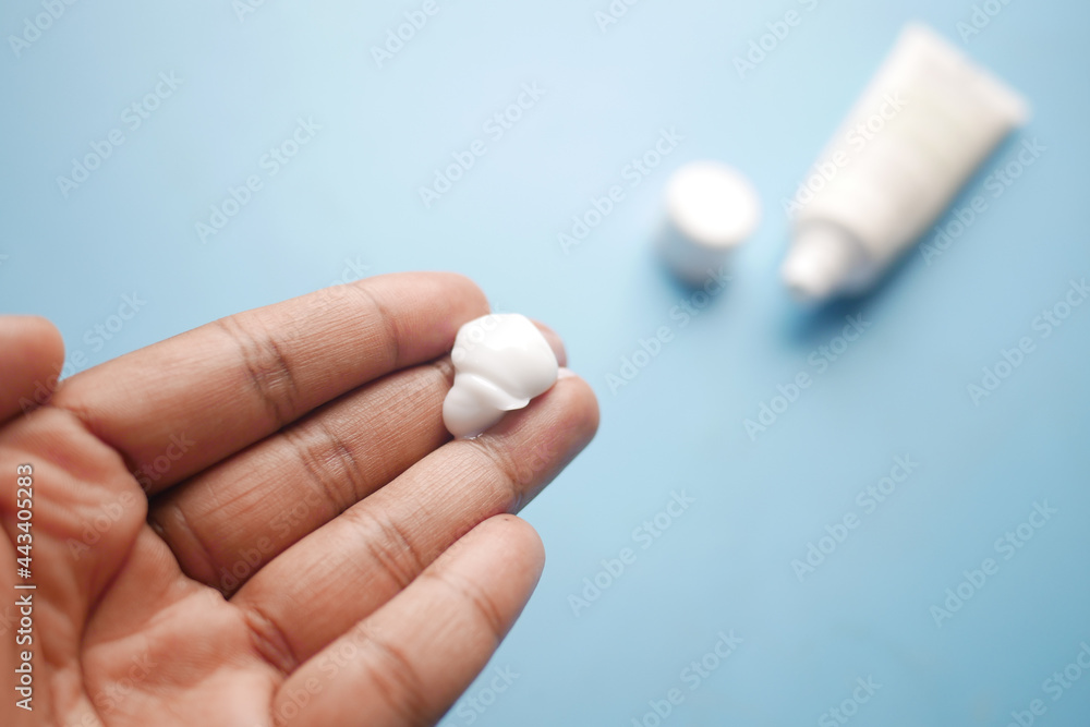 Man applying antibiotic cream close up Man applying antibiotic cream close up