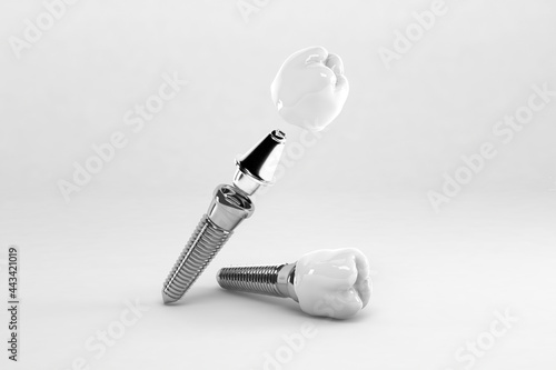 Detail of a false tooth implant fixed photo