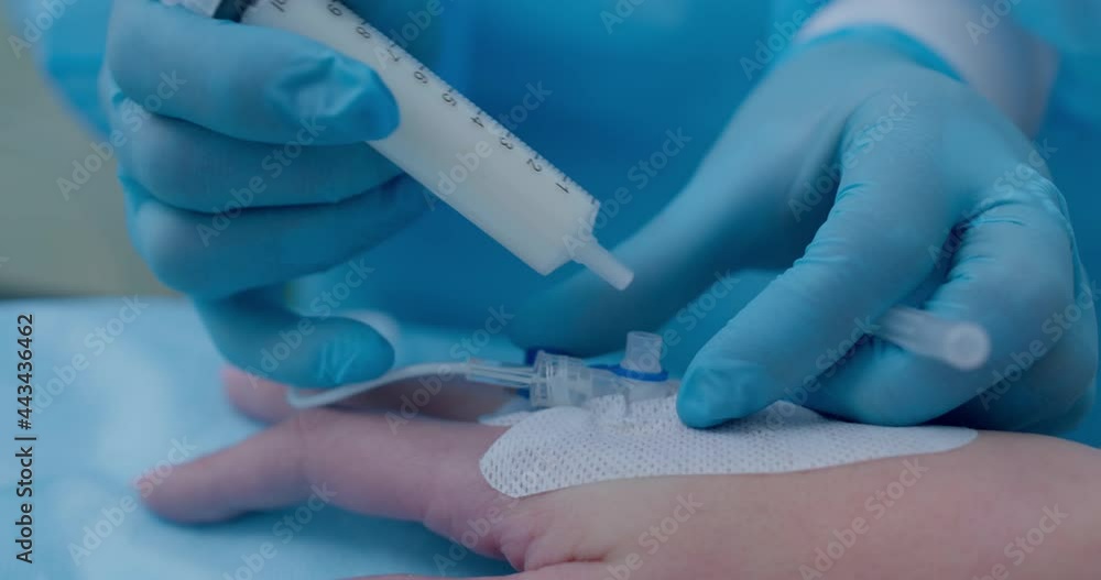 Close-up female hand, she is having a catheter inserted inside of a hand and a medical worker is inserting a syringe with the liquid inside of the catheter. Close-up female hand, she is having a catheter inserted inside of a hand and a medical worker is inserting a syringe with the liquid inside of the catheter.