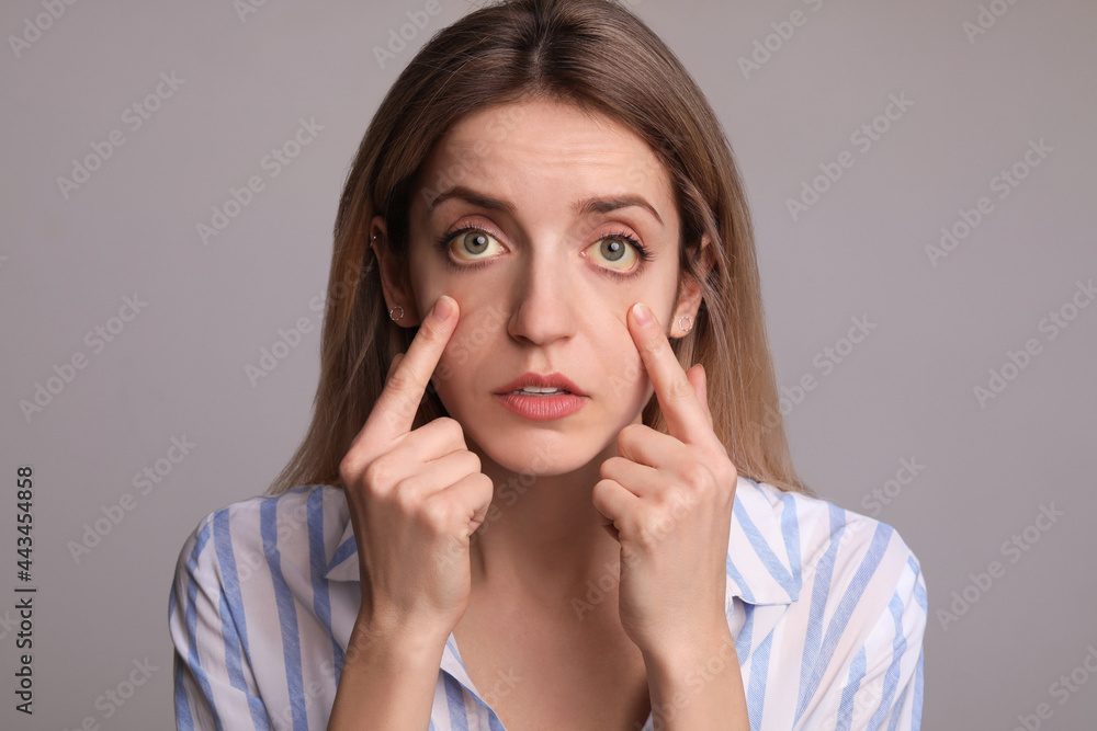 Woman checking her health condition on grey background. Yellow eyes as symptom of problems with liver Woman checking her health condition on grey background. Yellow eyes as symptom of problems with liver