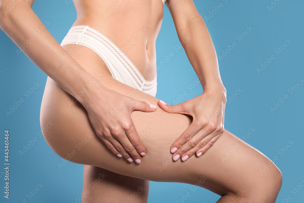 Closeup view of slim woman in underwear on light blue background. Cellulite problem concept