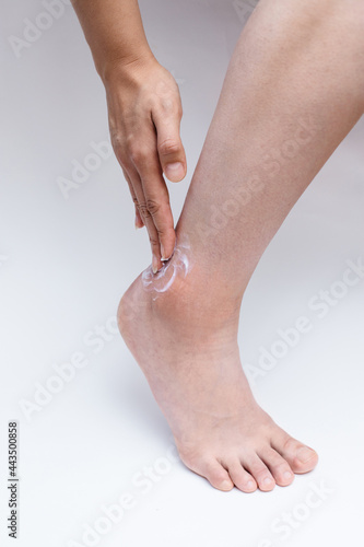 cream on the leg