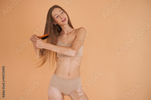 Photo Girl with vitiligo skin looking away and posing at the studio while combing her
