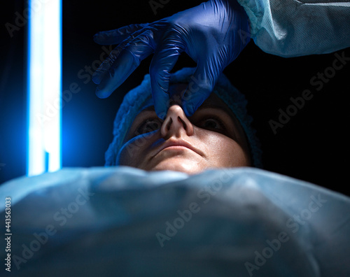 Fotografi correction of the nasal septum, defects in the shape of the nose in the female patient