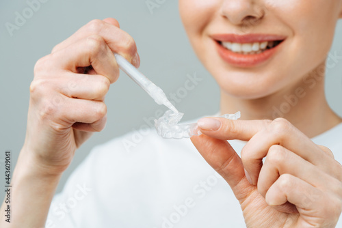 A young woman does a home teeth whitening procedure. Whitening tray with gel photo