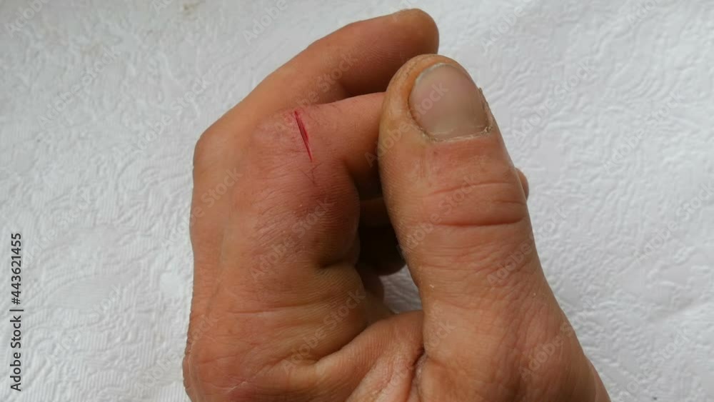 Deep cut on finger of men. Blood wound in phalanx Deep cut on finger of men. Blood wound in phalanx