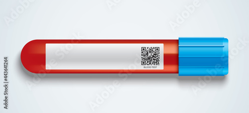 Blood test glass tube with a blank information label.
