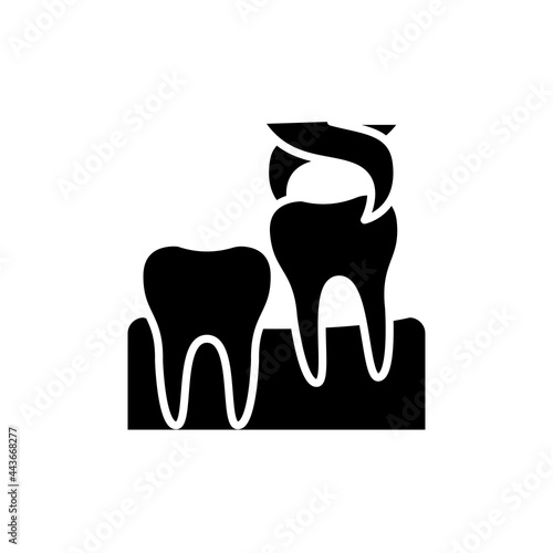 Wisdom tooth extraction line icon. Isolated vector element.