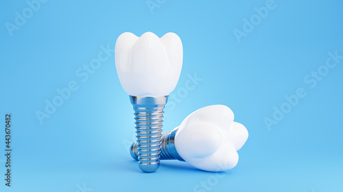 dental implant on blue background photo