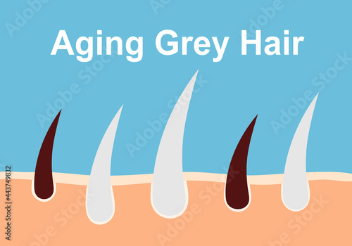 Aging grey root hair infographic in flat design.