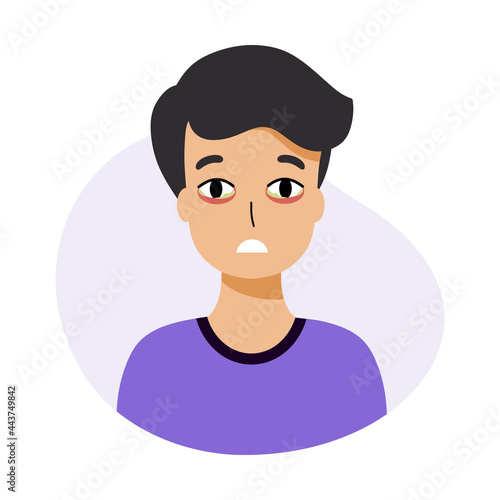 Boy with conjunctivitis. Inflammation of eyes in child. Symptom of viral and bacterial infection.