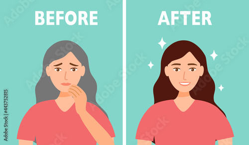 Woman before and after grey hair dye in flat design. Aging grey hair dying concept.