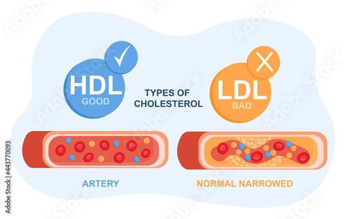 Types of cholesterol in the blood concept