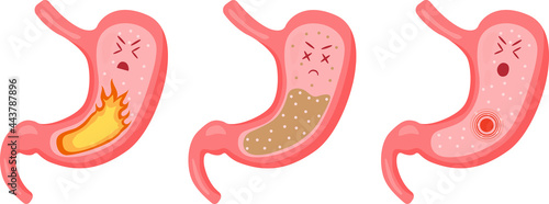 stomach healthy stomach sick set dd ww
