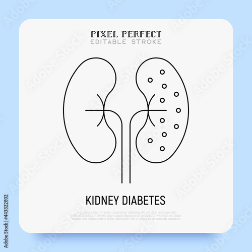 Kidneys diabetes thin line icon. Chronic disease. Pixel perfect, editable stroke. Vector illustration.
