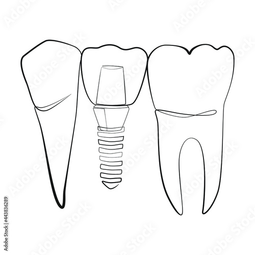 Natural and artificial teeth line drawing on white isolated background