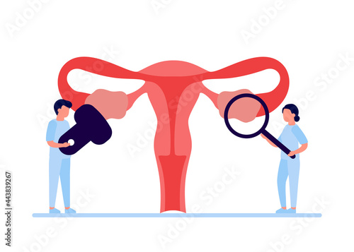Doctor checkup reproductive system of woman. Health and disease uterus and ovary internal organ. Polycystic ovary syndrome, inflammation, pain. Vector illustration