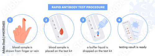 Covid-19 Rapid Antibody test procedure Infographic. Test kit with Patient blood sample. Buffer liquid on testing strip. Coronavirus certificate with Positive Result. Vector illustration.