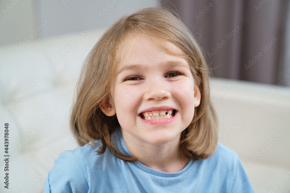 Little girl shows a reeling tooth. changing milk teeth to indigenous teeth. Little girl shows a reeling tooth. changing milk teeth to indigenous teeth.
