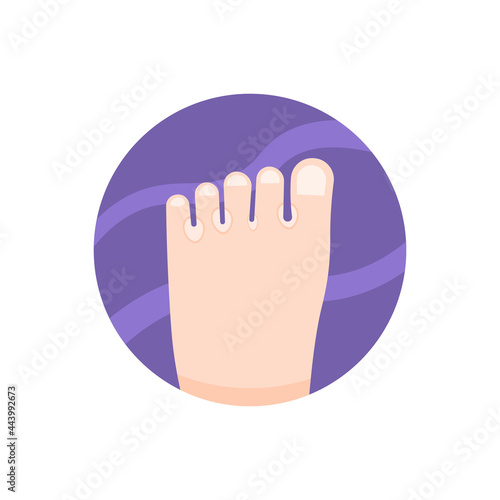 illustration of a foot affected by ringworm between the fingers. fungal skin disease. skin health conditions. flat cartoon style. vector design