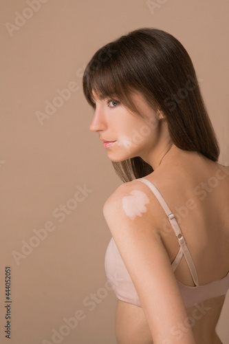 A young pretty long-haired woman with skin pigmentation looking aside photo