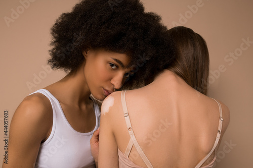 Two young beautiful women in lingerie hugging each other photo