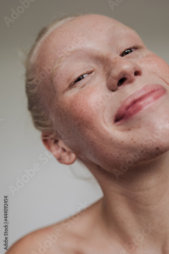 Young freckled girl photo