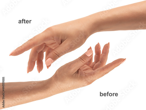 Beautiful Woman Hands. Female Hands before and after Applying Cream, Lotion. Spa and Manicure concept. Female hands with french manicure. Soft skin, skincare concept. Hand Skin Care.