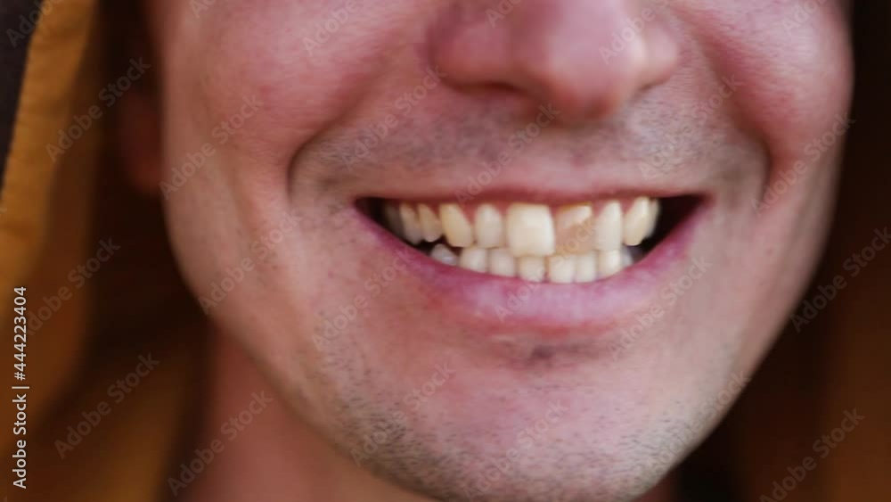 Yellow damaged tooth of smiling Caucasian man in the hood closeup