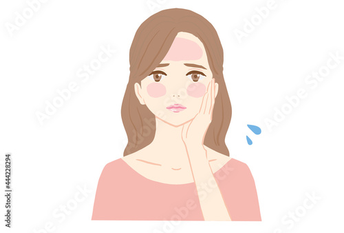 顔が日焼けして赤くなっている若い女性のイラスト