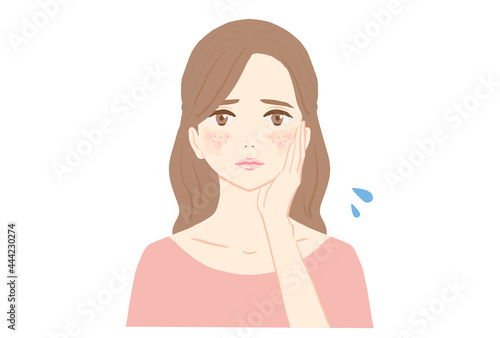 顔に吹き出物が出て悩む若い女性のイラスト