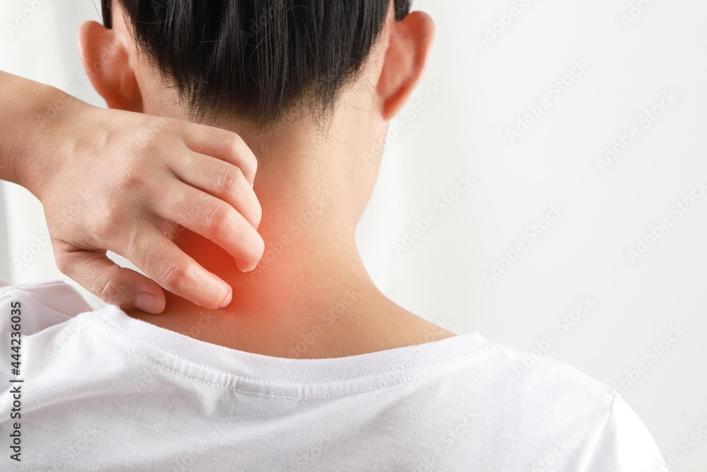 girl itching on the skin and scratching itchy allergic reaction to