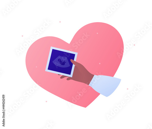 Ultrasound pregnancy diagnostic concept. Vector flat illustration. Female hand hold photo with baby in womb. Heart shape on background. Mother love symbol. Design for health care.