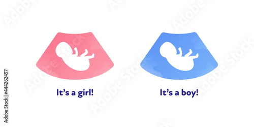 Ultrasound pregnancy diagnostic concept. Vector flat illustration. Ultrasonographer device with ultrasound and baby in womb symbol. It's girl, boy text. Design for health care, ultrasonography