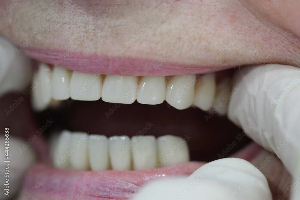 Obraz premium dentist works