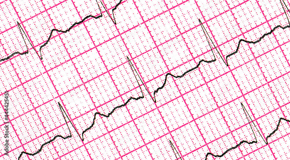 Cardiogram. Fragment of research result by CU Cardiogram. Fragment of research result by CU