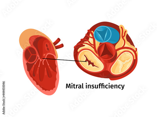 Heart Disease Poster