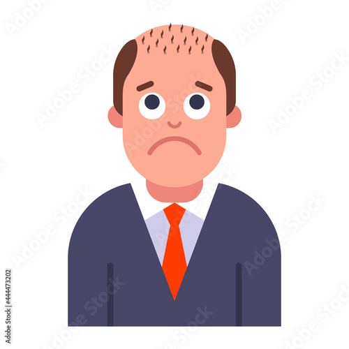a problem with male pattern baldness. hair loss on the head. flat vector illustration.