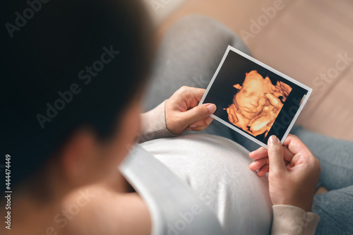 Asian pregnant woman holding ultrasound 4d scan image, Expectation of a child and Maternity prenatal care and woman pregnancy concept. photo