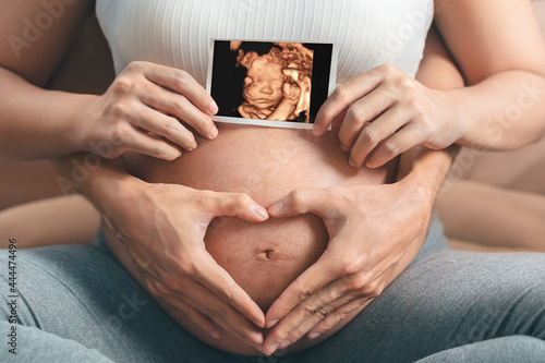 Asian pregnant woman and husband  holding hand together, holding ultrasound 4d scan image and making hand heart gesture on her belly,  Expectation of child and woman pregnancy concept.