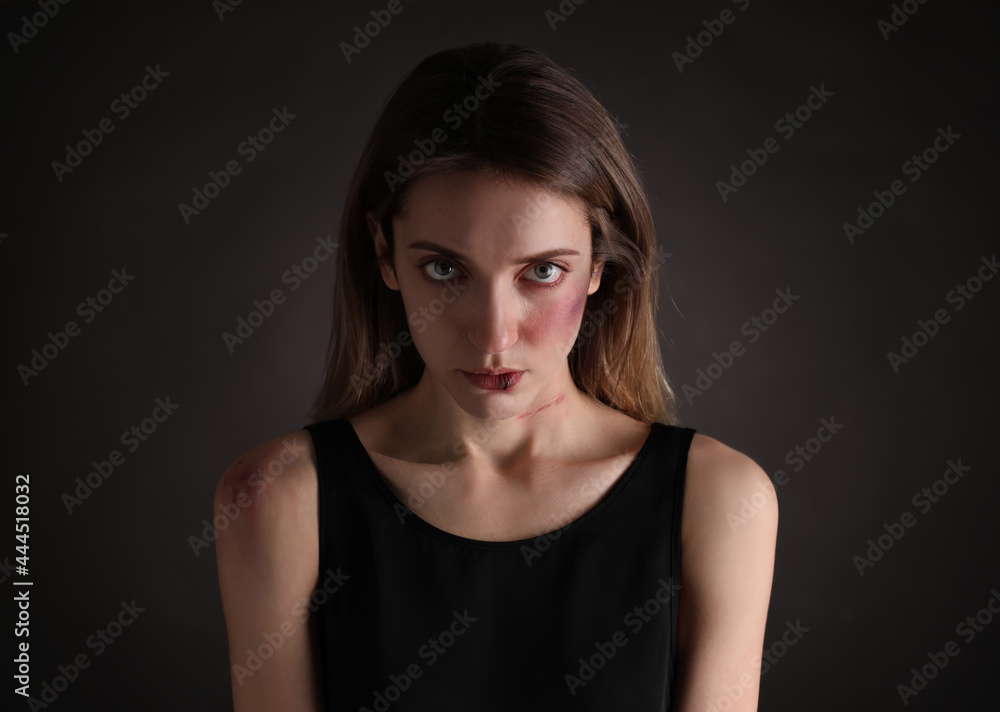 Woman with facial injuries on black background. Domestic violence victim Woman with facial injuries on black background. Domestic violence victim