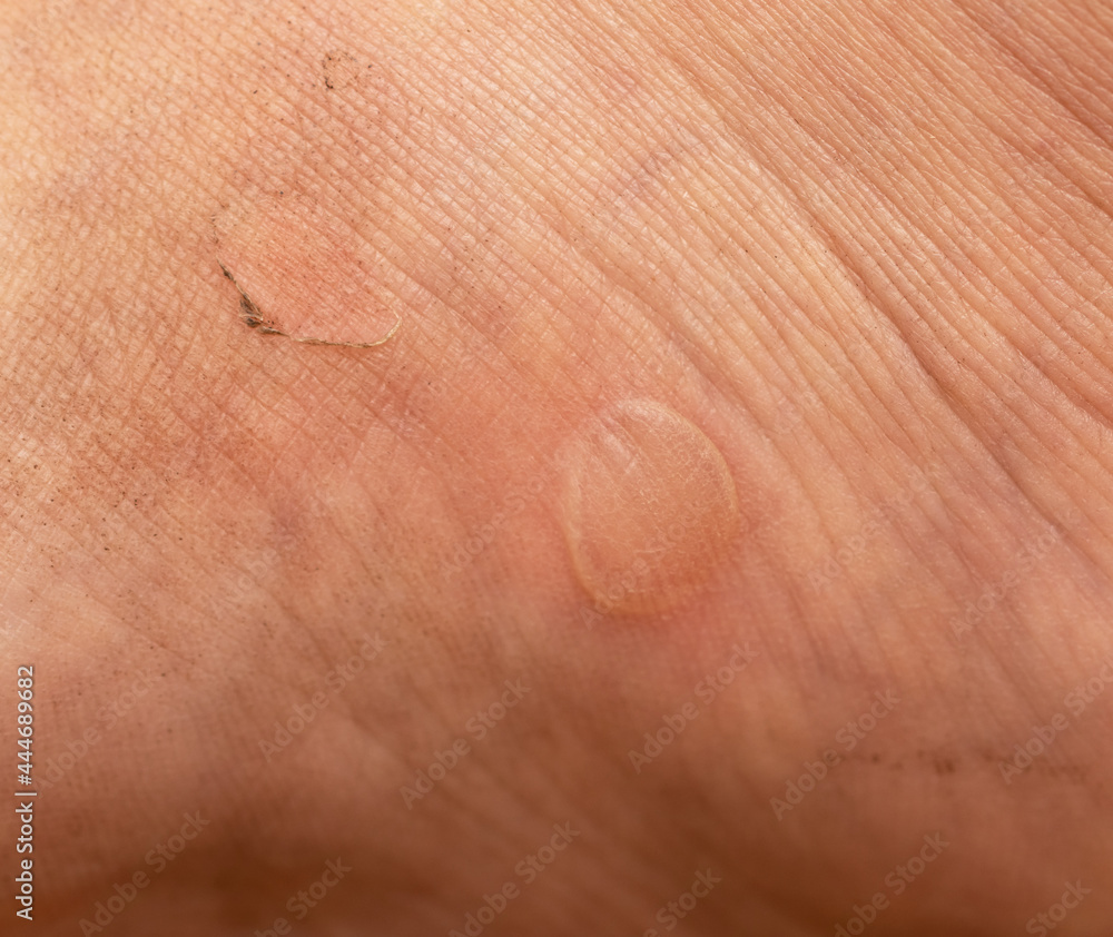 Fototapeta premium callus from shoes as a background