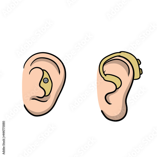 Hearing aid. Audiphone in ear. Set of Cartoon illustration. Hearing problems and disabilities