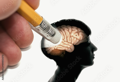 Принти на полотні Memory loss concept. Dementia, Alzheimer's Syndrome, Amnesia.