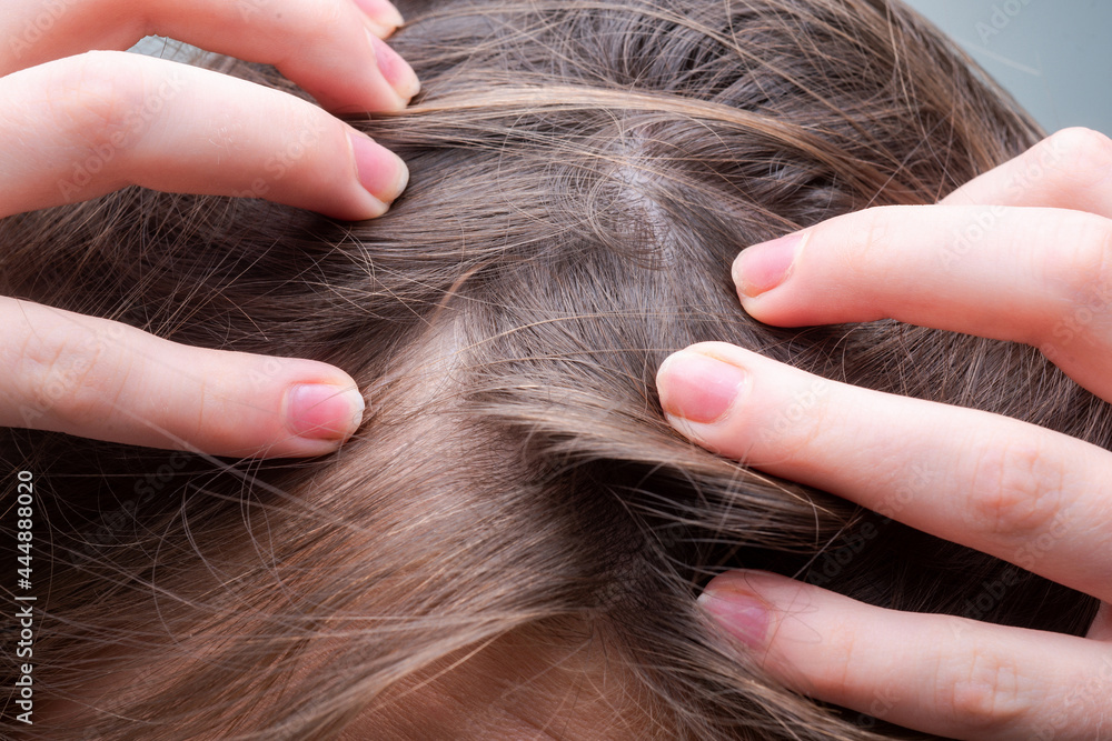 Obraz premium Hair loss close up. Tangled problem hair macro.