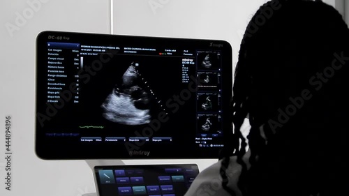 santo domingo, república dominicana - 22 de marzo de 2021 - joven médico examinando la radiografía de un paciente, monitor mindray de alta tecnología