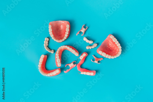 Dental prosthetics on a blue background. Dentures. Prosthetic teeth. False teeth. Prosthetic dentistry. Set of dentures on a blue background. Top view of complete denture on blue background photo