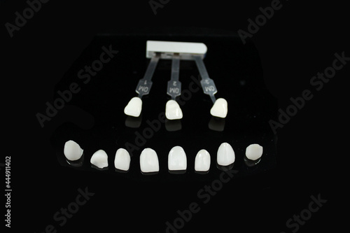 Compare the color with shade guide of the veneer teeth for dental treatment