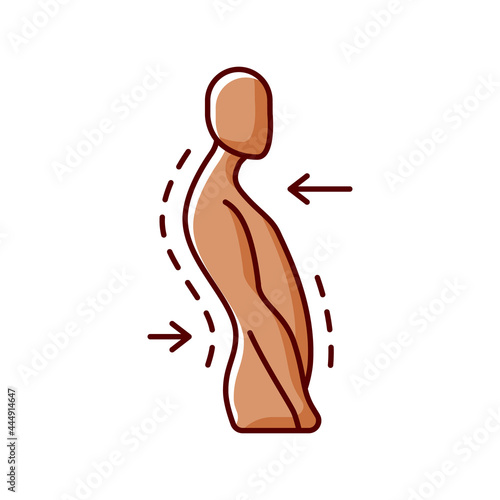 Swayback posture RGB color icon. Spine curvature disorder. Poor posture. Postural deformity. Backward thoracic spine movement. Ligament sprain. Muscle imbalances. Isolated vector illustration