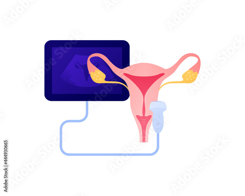 Medical ultrasound procedure concept. Vector flat healthcare illustration. Female reproductive system and uterus diagnostic color icon symbol. Ultrasonography device symbol. Design for health care.